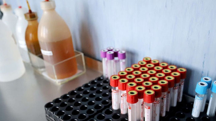 Две учителки от детска градина в Перник са с COVID-19